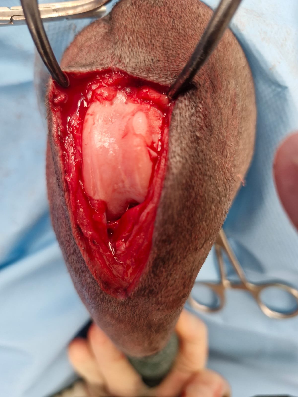 Fracture repair case